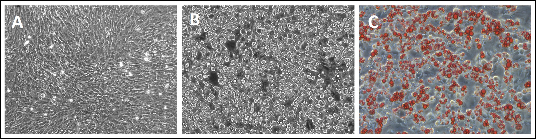 Adipocyte differentiation